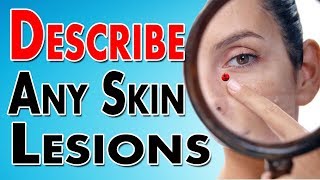 Describing Skin Lesions [upl. by Dowzall929]