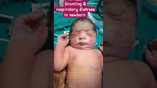 Respiratory distress amp grunting in newborn baby newborn viralvideo babyshorts love nicu cute [upl. by Oilenroc]