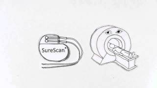 Medtronic SureScan Technology [upl. by Hluchy]