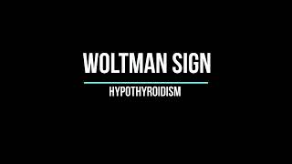 Woltman sign [upl. by Anirrehs]