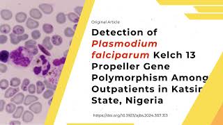 Detection of Plasmodium falciparum Kelch 13 Propeller Gene Polymorphism Among Outpatients [upl. by Refiffej]