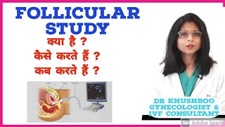 Follicular Study क्या होती है Hindi  Dr Khushboo  Mannat IVF Patna [upl. by Aerdnahs]