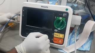 Philips Difibrilator DFM 100 Testing amp Analyser Procedure [upl. by Trevorr]