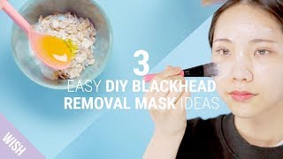 3 Home Remedies For Different Types of Blackhead Concerns  DIY Blackhead Remover Mask [upl. by Esinad]