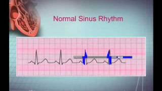 Intro EKG Interpretation Part 1 [upl. by Tse]