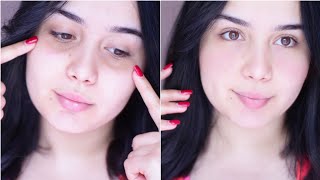 طريقة التخلص سريعا من الهالات السوداء طبيعيا  Bye Bye Dark Circles [upl. by Mcgray]