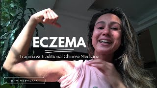 Eczema Trauma amp Traditional Chinese Medicine Week 5 in Taiwan [upl. by Oinegue]