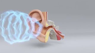 Explore the Science of Hearing Loss  MiracleEar Hearing Center [upl. by Bluhm]