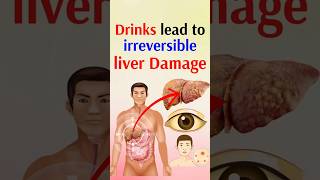 Drinks lead to irreversible liver damage [upl. by Joris482]