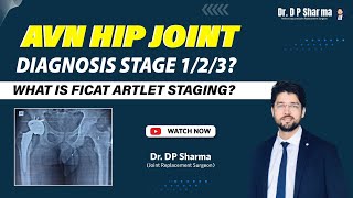 Diagnosis of AVN Hip XrayMRI Stage 123 Ficat and Artlet Classification amp Treatment In Delhi NCR [upl. by Renckens798]