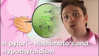 H pylori  Hashimotos and Hypothyroidism [upl. by Ellesij]