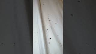 healing fungus mold skin morgellons disease alien implant health help faith raredisease [upl. by Ahsietal824]