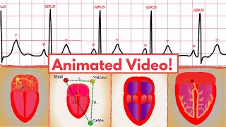 Sinus Rhythm 5 simple steps for interpretation on an ECGEKG [upl. by Aun]