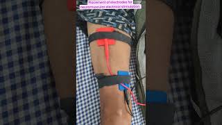 Placement of electrode for neuromuscular electrical muscle stimulation for ms reeducationshorts [upl. by Notnil]