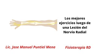 Los mejores ejercicios luego de una Lesión del Nervio Radial  FisioterapiaRD [upl. by Nevear]