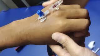 IV cannulation procedure [upl. by Pas]