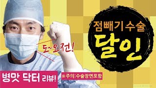 점빼기점빼는영상 폭망 점빼기후기 리뷰 [upl. by Pare]