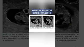 EL EMBRIÓN AUMENTA DE TAMAÑO 1 mm POR DIA [upl. by Philbo758]