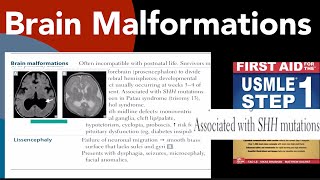 Brain malformations Holoprosencephaly amp Lissencephaly in HindiUrdu by first aid for USMLE step 1 [upl. by Llevart61]