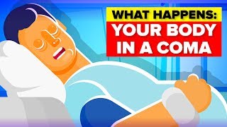 What Happens To Your Body in a Coma [upl. by Rollins]