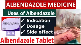 Albendazole tablets uses  ip 400mg  doses for adults and children and common side effects [upl. by Ajaj]