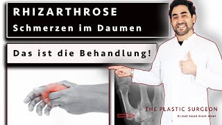 Rhizarthrose  das ist die Behandlung Schmerzen im Daumensattelgelenk  Dr Alawi [upl. by Dell]