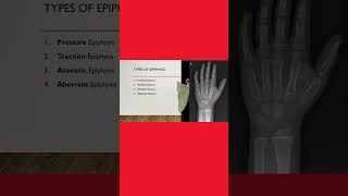 4️⃣ Types of epiphysis 🦴 anatomy anatomylectures osteology medicalstudent [upl. by Brahear]