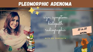 pleomorphic adenoma I oral pathology lectures [upl. by Oriane]