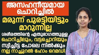 ശരീരത്തിന്റെ ഏതുഭാഗത്തുള്ള ചൊറിച്ചിലും വട്ടച്ചൊറിയും മാറാൻ നല്ല നാച്ചുറൽ ഹോം റെമഡിvattachori maran [upl. by Lainahtan]