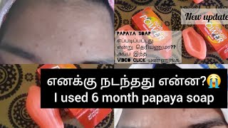 😱😱I used papaya soap 6 month 😭 இப்படி நடக்கும் என்று நான் நினைக்கவே இல்ல😰😰 [upl. by Nnaeed]