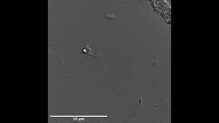 apoptosing Trichoplax cells [upl. by Eniak]