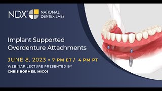 Implant Supported Overdenture Attachments [upl. by Siriso]