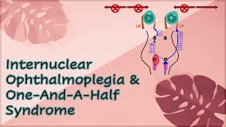 Internuclear Ophthalmoplegia amp One And A Half Syndrome [upl. by Alejoa85]