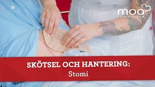 Skötsel och hantering  Stomi [upl. by Willmert]