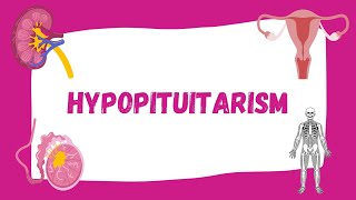 Hypopituitarism  Causes Symptoms Diagnosis Treatment  Endocrinology [upl. by Vere]