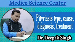 Pityriasis type cause diagnosis treatment  सिहुली DrDeepak Singh [upl. by Khan35]