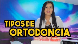 Tipos de BracketsOrtodoncia – Odontología Láser [upl. by Jeaz]