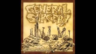 General Surgery  Left Hand Pathology 2006 Full Album [upl. by Ahouh]