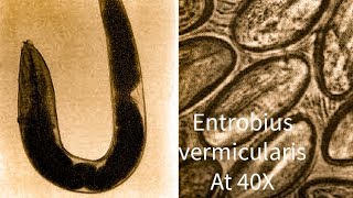 Entrobius vermicularis Pin Worm under microscope at 40 X [upl. by Sanoy]