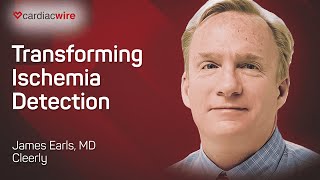 The Cardiac Wire Show – Transforming Ischemia Detection [upl. by Rillis396]