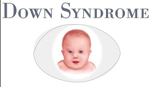 Downs Syndrome learn everything about down syndrome in 5 minutes  introduction assessment types [upl. by Einehpets]