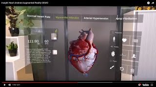 Insight Heart App  Augmented Reality Android App DEMO [upl. by Nertie]