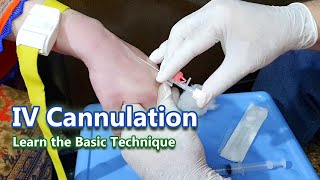 IV Cannulation  Learn the Basic Technique  IV Cannula [upl. by Ahsym]