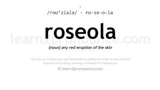 Pronunciation of Roseola  Definition of Roseola [upl. by Felt804]