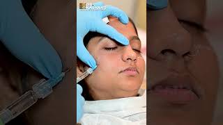 Under Eye Filler Treatment with DrPooja Kasanas [upl. by Brad]