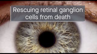 Finding the time window to rescue dying retinal ganglion cells applications to glaucoma [upl. by Harriett174]