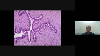 Breast Pathology basics [upl. by Hsirrehc280]