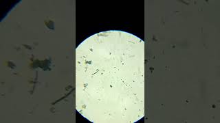 Que son los paramecios bueno aquí te explico ciencia microscope [upl. by Arjun]