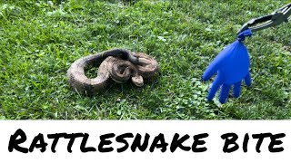 Rattlesnake Bite  Slow Motion Footage [upl. by Amliv]