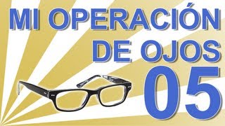 OPERACIÓN DEL SEGUNDO OJO  Experiencia personal operación ojos lentes intraoculares C05 [upl. by Asreht]